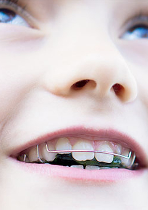 小児矯正歯科のイメージ