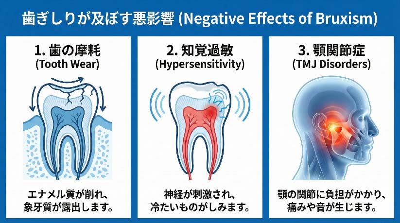歯ぎしりが歯や顎に与える悪影響（摩耗・知覚過敏・顎関節）の図解