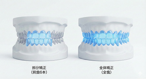 部分矯正と全体矯正の治療範囲の違いを示すイラスト