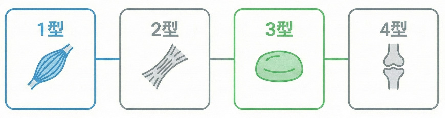 顎関節症の1型から4型までの分類と症状の比較表