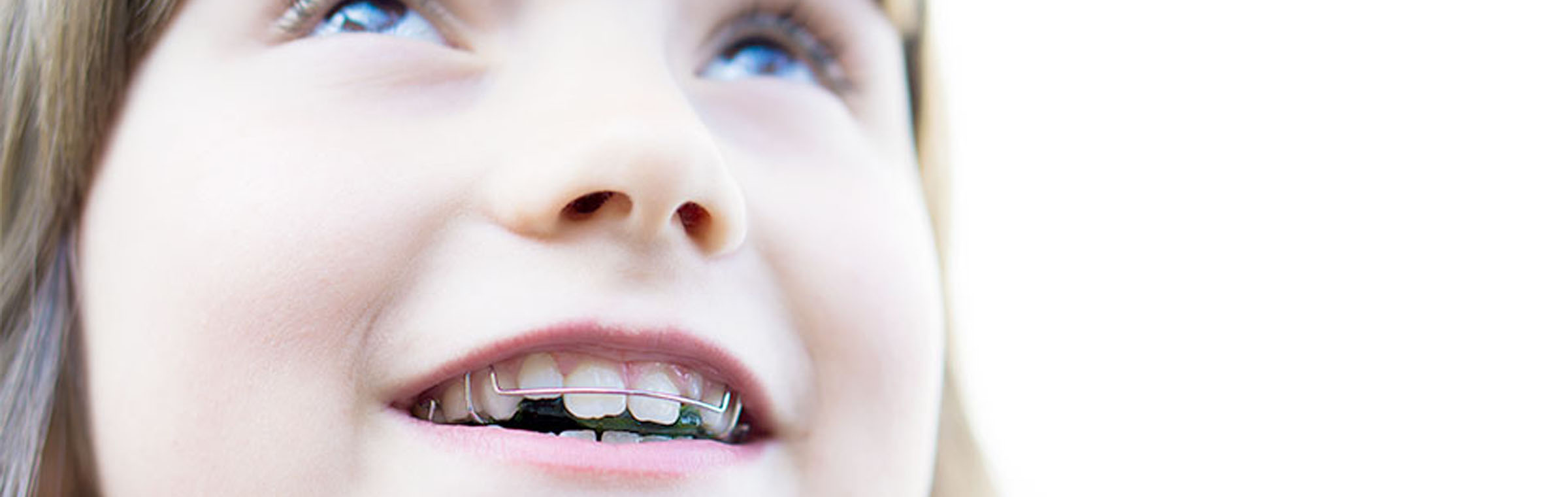 小児矯正歯科のイメージ